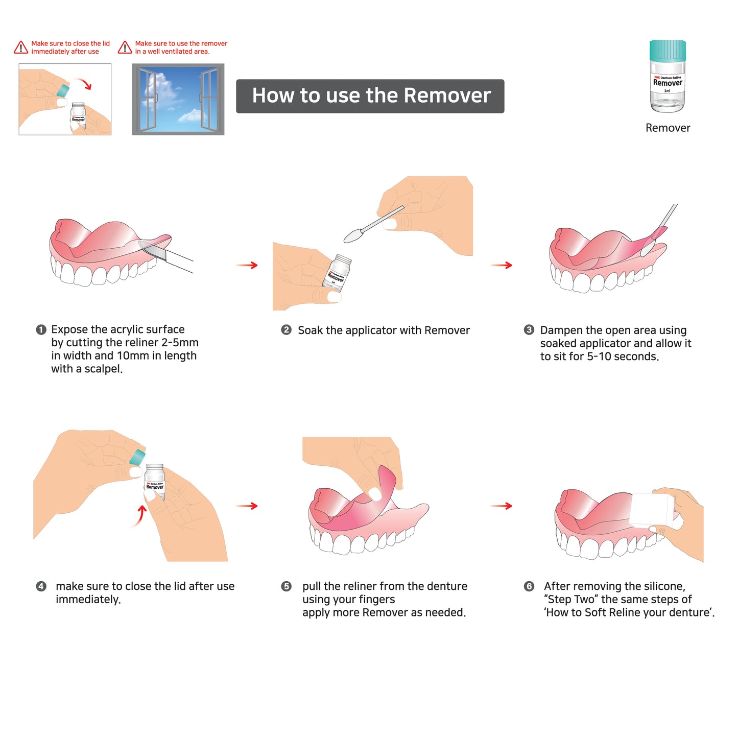 E&E Soft Denture Reline Kit β Upper & Lower Dentures