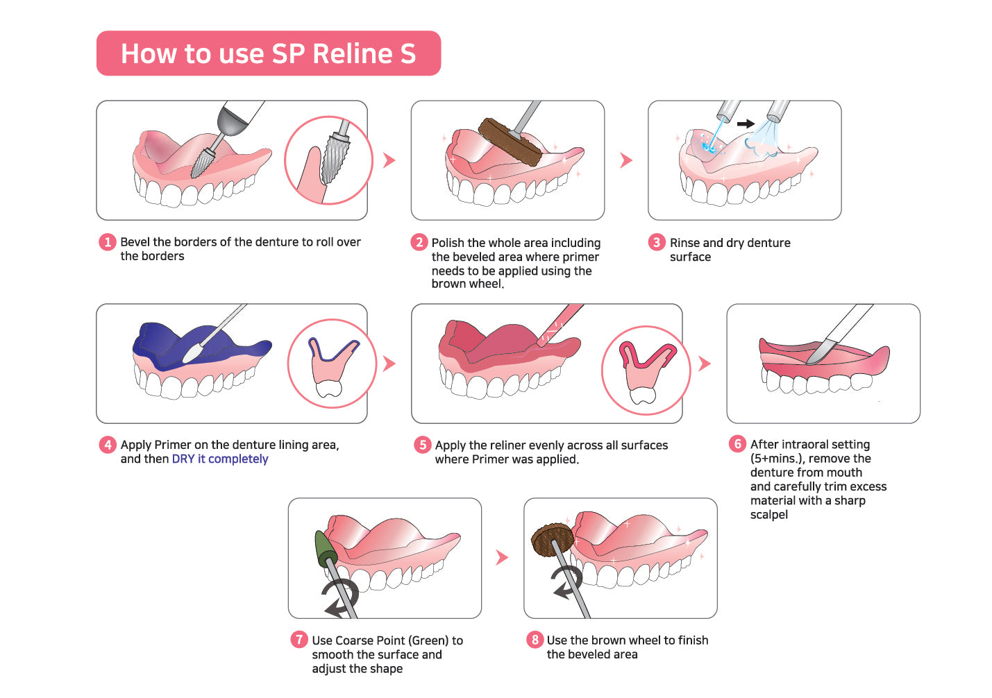 Denture Reline Technique at Ryan Knight blog